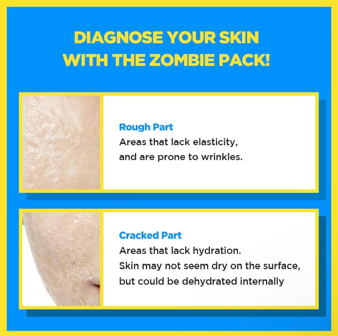 Zombie Pack & Activator Kit